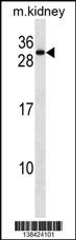 Western blot analysis in mouse kidney tissue lysates (35ug/lane).