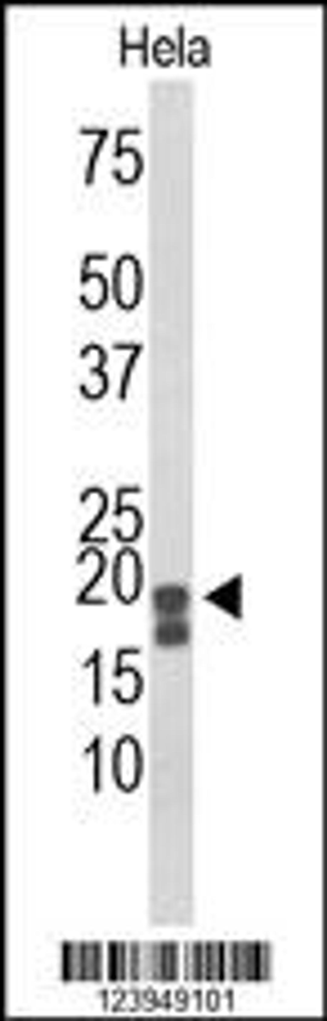 Western blot analysis of ACP1 Antibody in Hela cell line lysates (35ug/lane)