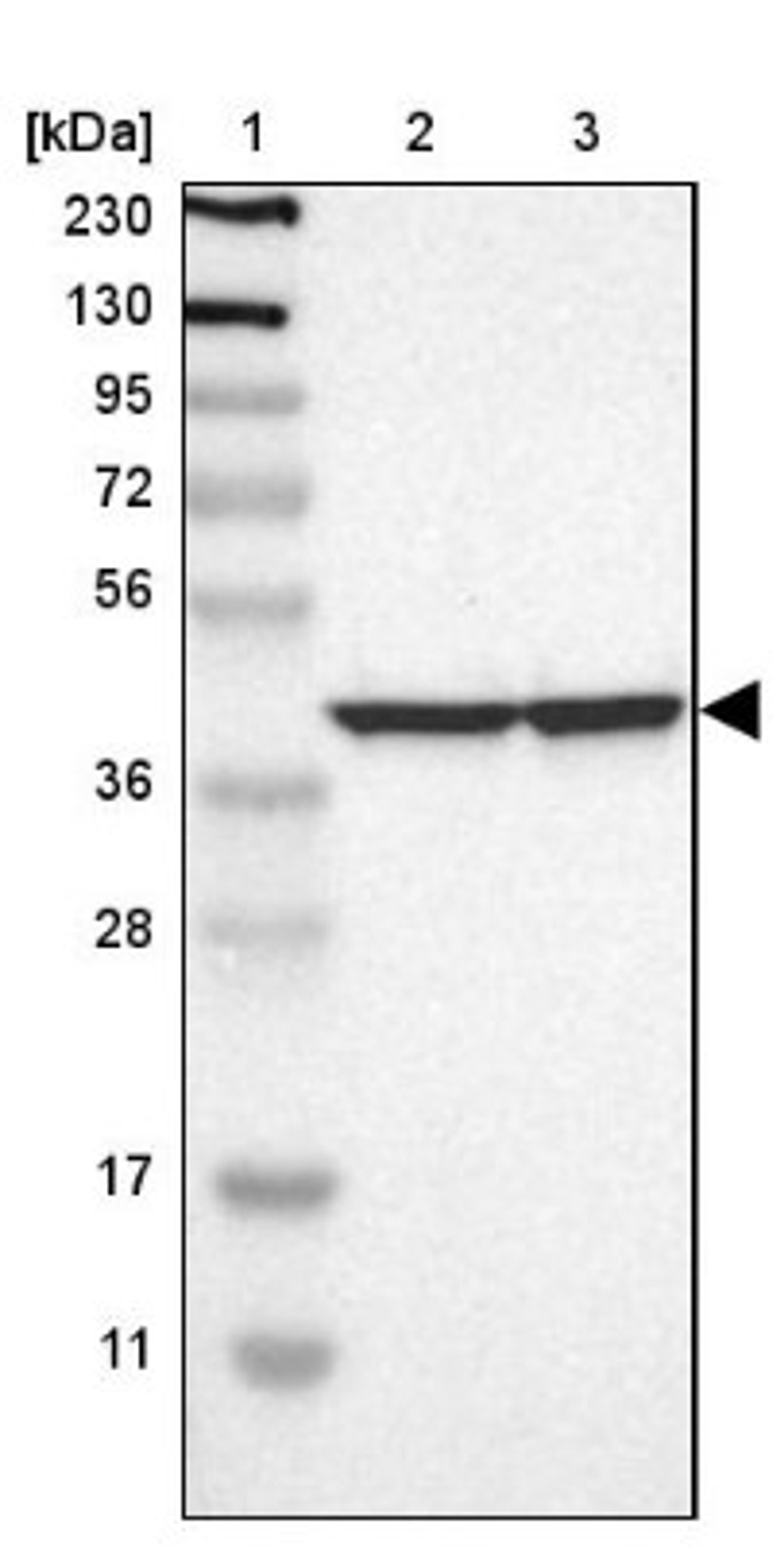 Western Blot: LRPAP1 Antibody [NBP1-89334] - Lane 1: Marker [kDa] 230, 130, 95, 72, 56, 36, 28, 17, 11<br/>Lane 2: Human cell line RT-4<br/>Lane 3: Human cell line U-251MG sp