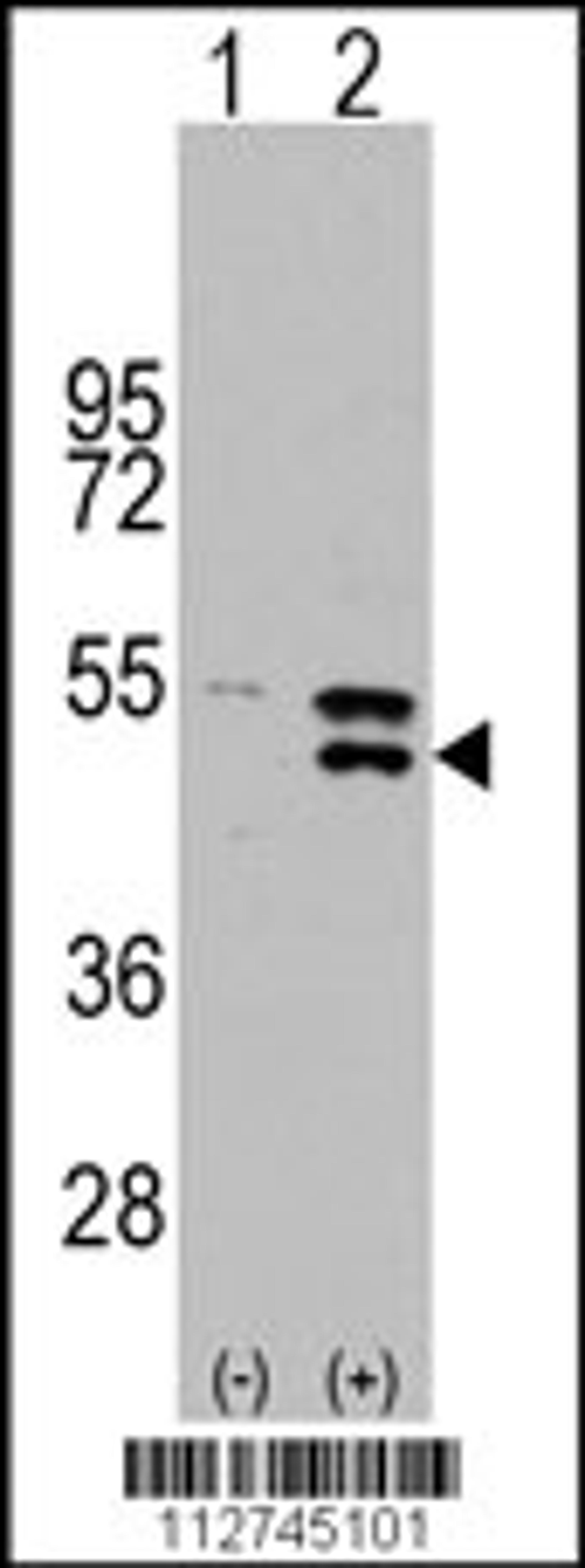 Western blot analysis of MAP2K5 using rabbit polyclonal MAP2K5 Antibody (S149).293 cell lysates (2 ug/lane) either nontransfected (Lane 1) or transiently transfected with the MAP2K5 gene (Lane 2).