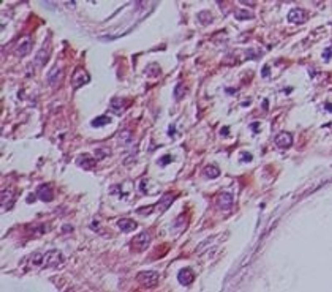 Immunohistochemistry-Paraffin: Humanin Antibody [NB100-56877] - IHC analysis Humanin in human testis using Humanin antibody at 1:100.