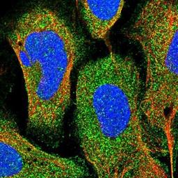 Immunocytochemistry/Immunofluorescence: FHIT Antibody [NBP1-89061] - Staining of human cell line U-2 OS shows positivity in cytoplasm.