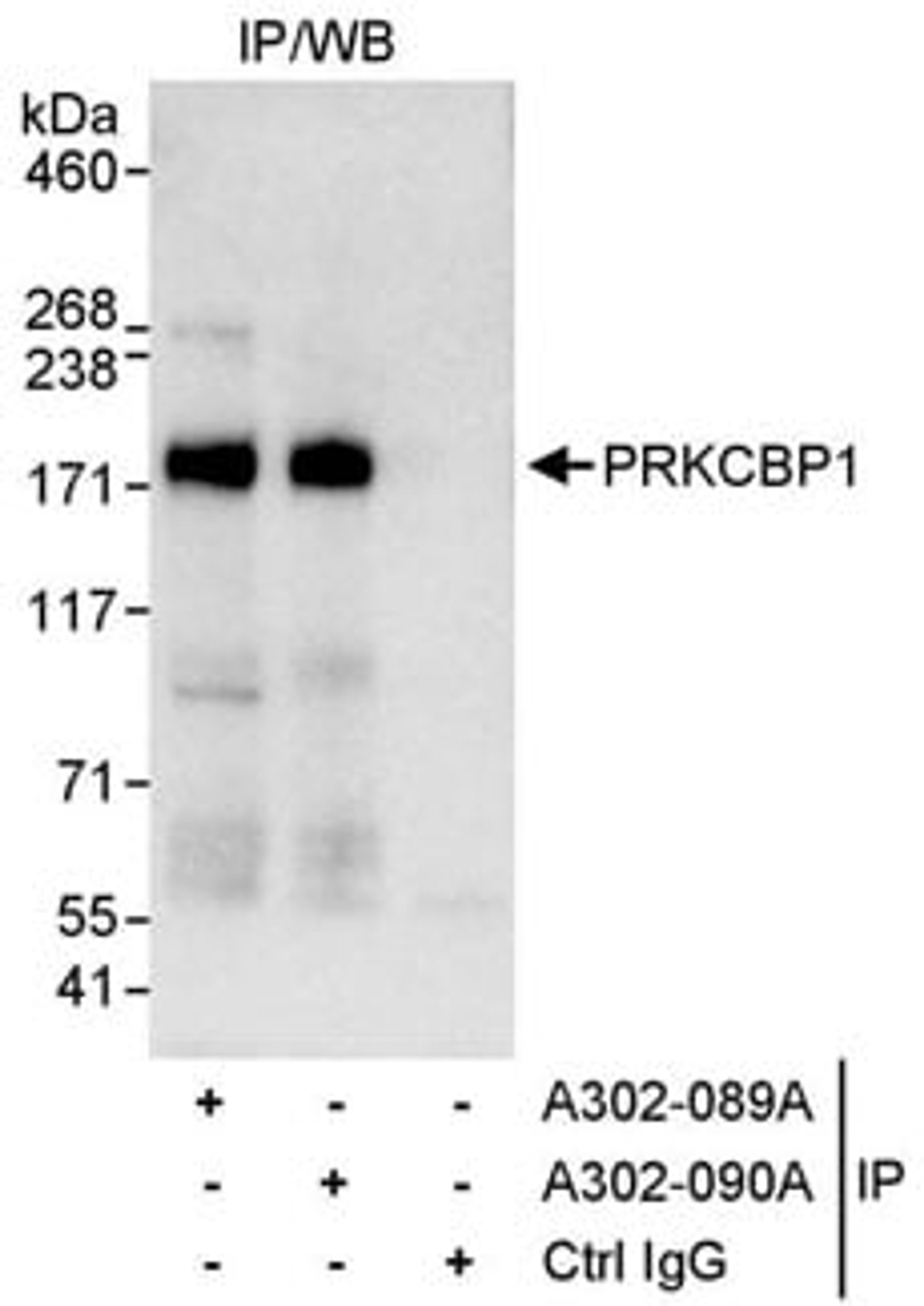 Detection of human PRKCBP1 by western blot of immunoprecipitates.