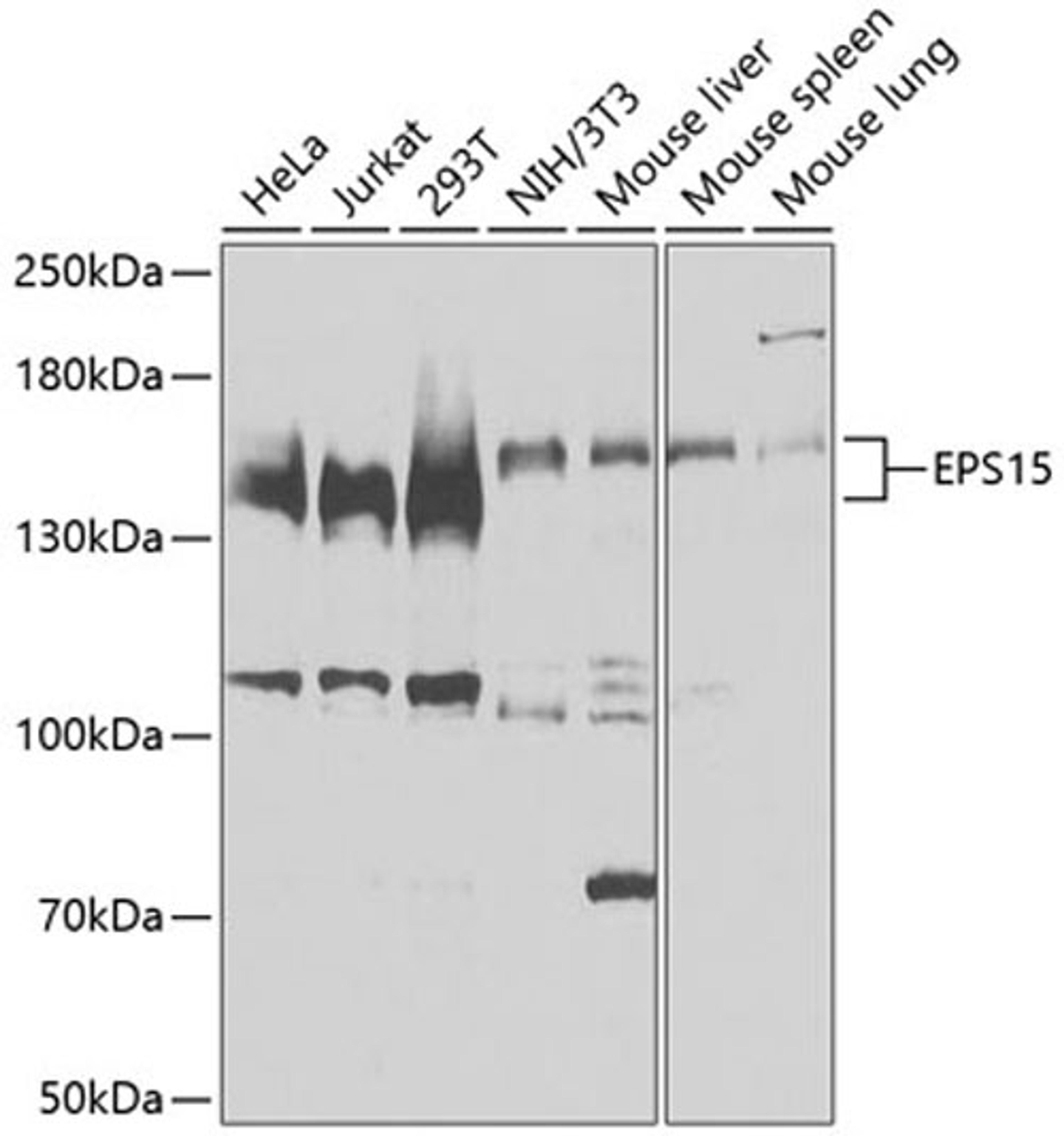 Western blot - EPS15 antibody (A9814)