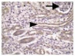 Immunohistochemistry-Paraffin: Meckelin Antibody [NBP1-06590] - Staining of kidney tissue section with Meckelin Antibody (NBP1-06590).