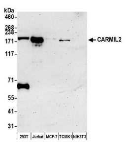 Detection of human and mouse CARMIL2 by WB.