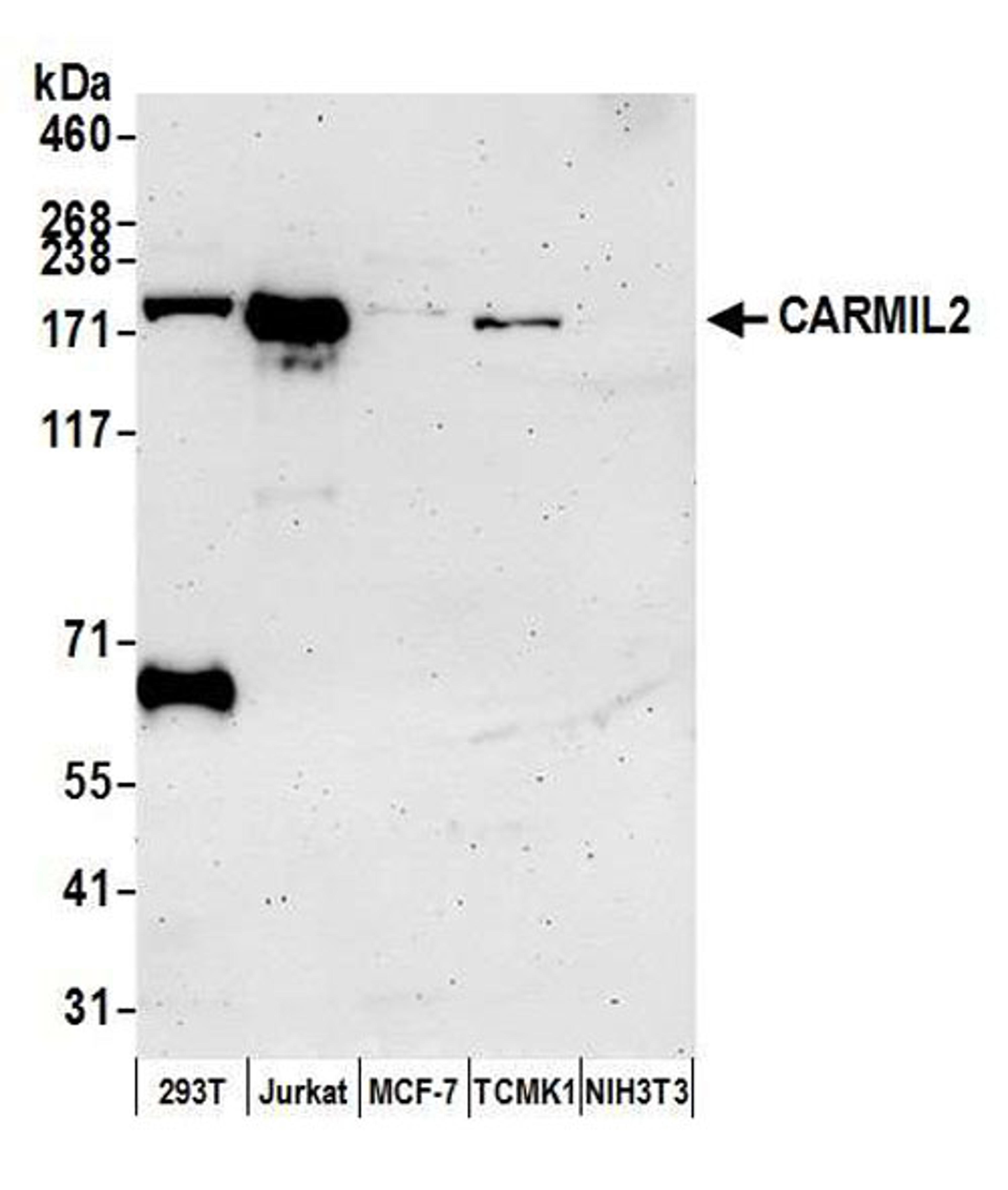 Detection of human and mouse CARMIL2 by WB.