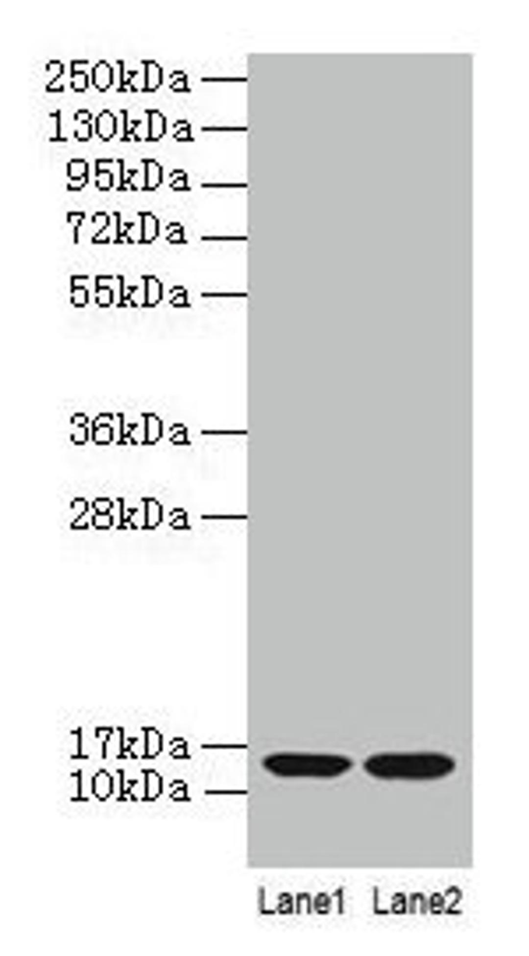Western blot. All lanes: B2M antibody at 2µg/ml. Lane 1: A431 whole cell lysate. Lane 2: Mouse lung tissue. Secondary. Goat polyclonal to rabbit IgG at 1/10000 dilution. Predicted band size: 14 kDa. Observed band size: 14 kDa