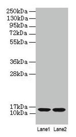 Western blot. All lanes: B2M antibody at 2µg/ml. Lane 1: A431 whole cell lysate. Lane 2: Mouse lung tissue. Secondary. Goat polyclonal to rabbit IgG at 1/10000 dilution. Predicted band size: 14 kDa. Observed band size: 14 kDa