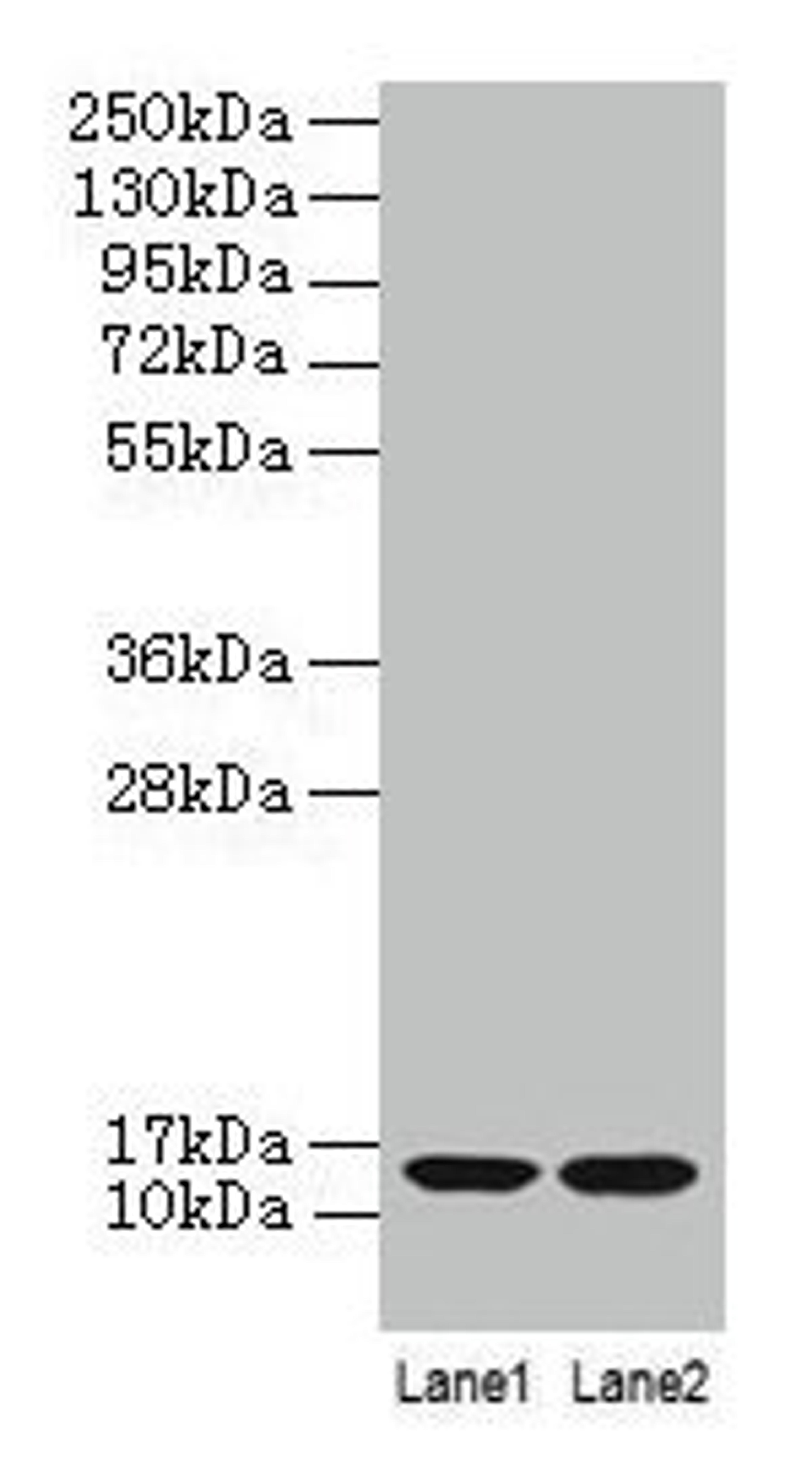 Western blot. All lanes: B2M antibody at 2µg/ml. Lane 1: A431 whole cell lysate. Lane 2: Mouse lung tissue. Secondary. Goat polyclonal to rabbit IgG at 1/10000 dilution. Predicted band size: 14 kDa. Observed band size: 14 kDa