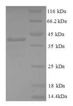 (Tris-Glycine gel) Discontinuous SDS-PAGE (reduced) with 5% enrichment gel and 15% separation gel.