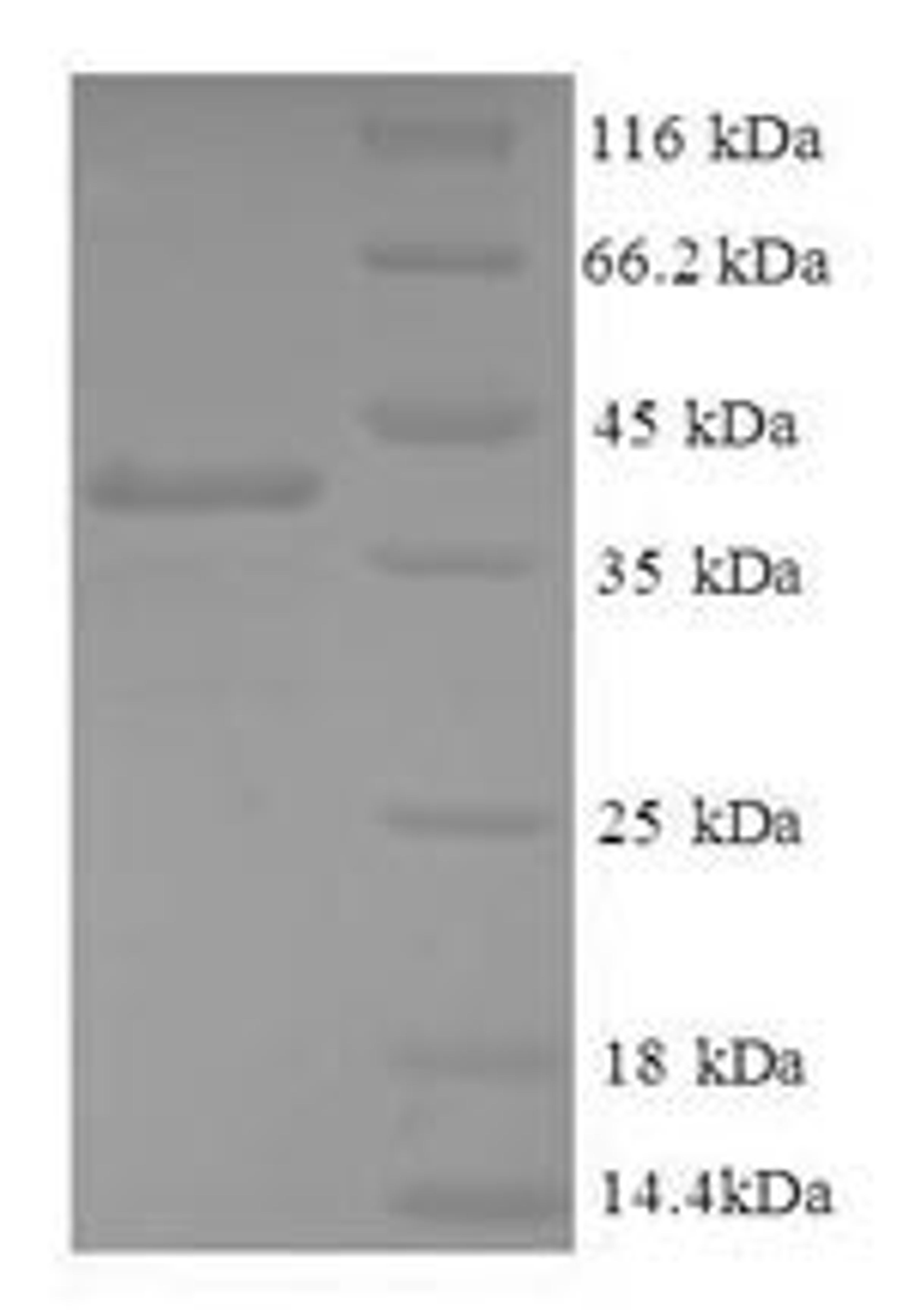 (Tris-Glycine gel) Discontinuous SDS-PAGE (reduced) with 5% enrichment gel and 15% separation gel.