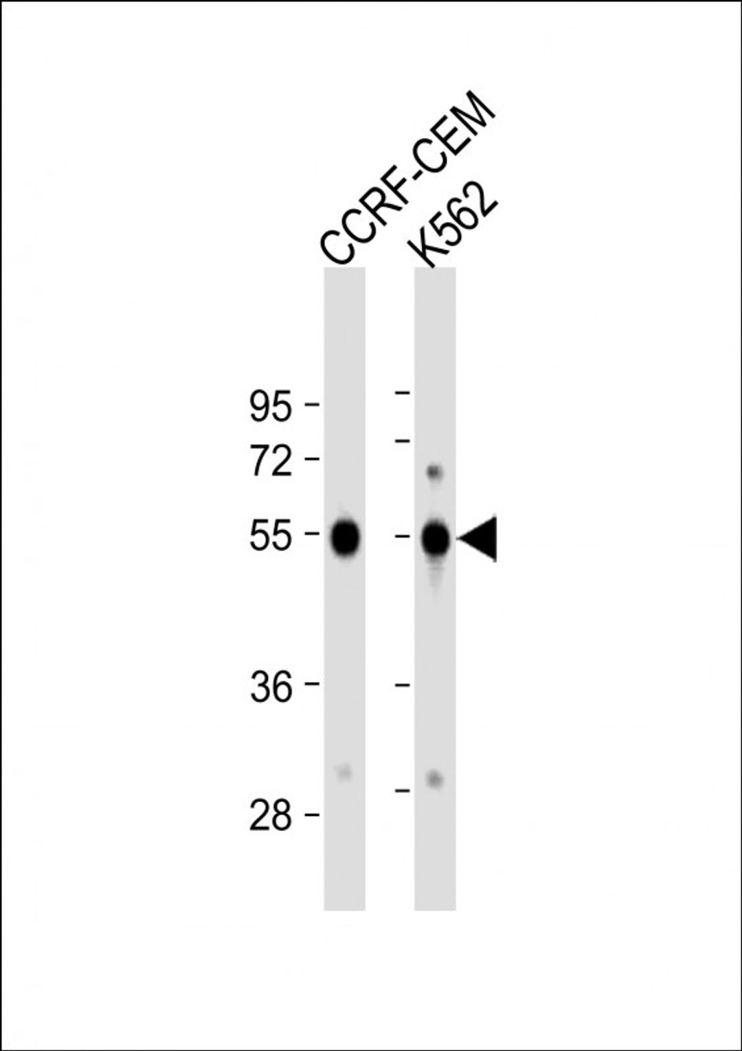 Western Blot at 1:1000 dilution Lane 1: CCRF-CEM whole cell lysate Lane 2: K562 whole cell lysate Lysates/proteins at 20 ug per lane.