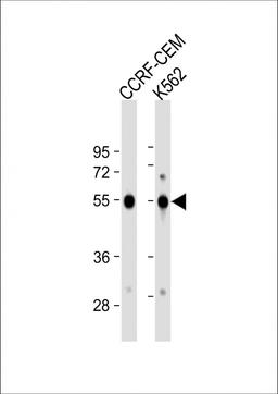 Western Blot at 1:1000 dilution Lane 1: CCRF-CEM whole cell lysate Lane 2: K562 whole cell lysate Lysates/proteins at 20 ug per lane.