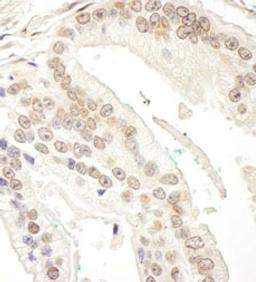 Detection of human RBM34 by immunohistochemistry.