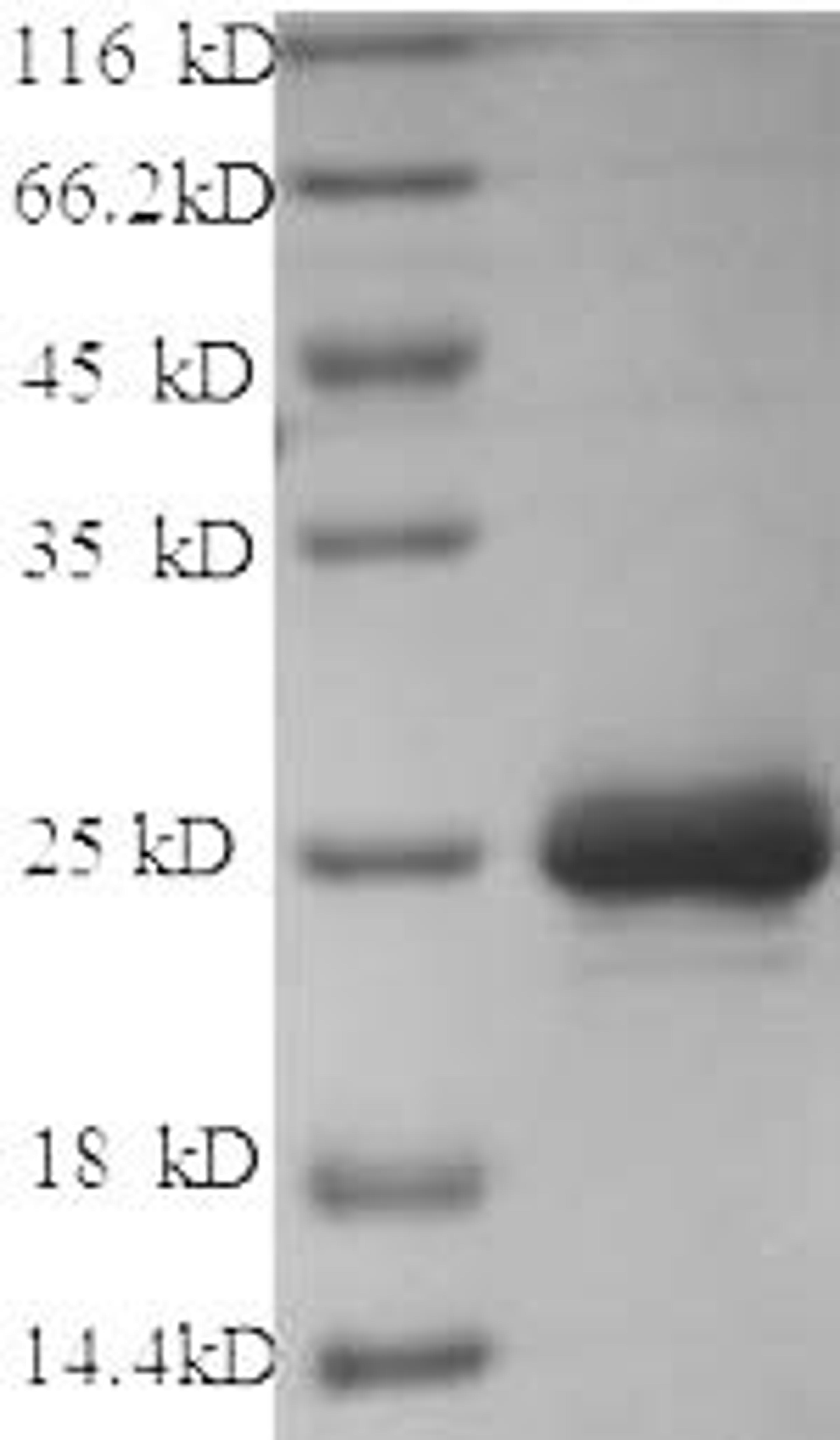 (Tris-Glycine gel) Discontinuous SDS-PAGE (reduced) with 5% enrichment gel and 15% separation gel.
