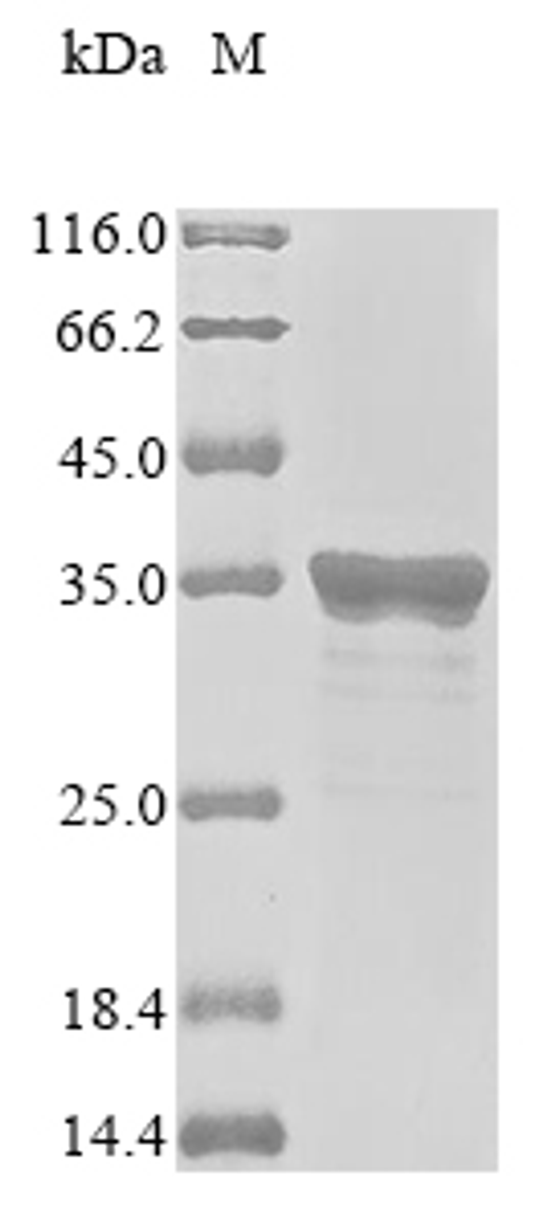 (Tris-Glycine gel) Discontinuous SDS-PAGE (reduced) with 5% enrichment gel and 15% separation gel.