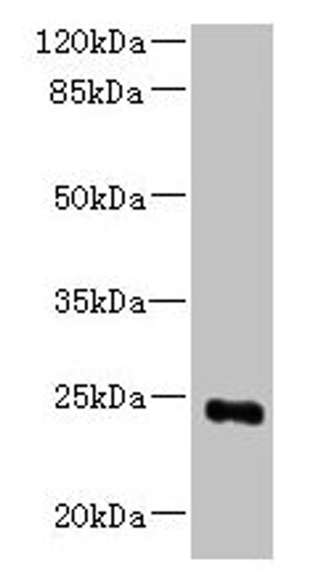 Western blot. All lanes: MED18 antibody at 0.8µg/ml + 293T whole cell lysate. Secondary. Goat polyclonal to rabbit IgG at 1/10000 dilution. Predicted band size: 24 kDa. Observed band size: 24 kDa