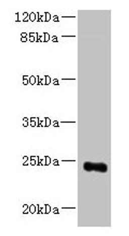 Western blot. All lanes: MED18 antibody at 0.8µg/ml + 293T whole cell lysate. Secondary. Goat polyclonal to rabbit IgG at 1/10000 dilution. Predicted band size: 24 kDa. Observed band size: 24 kDa