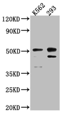 Western Blot. Positive WB detected in: K562 whole cell lysate, 293 whole cell lysate. All lanes: Caspase-2 antibody at 1:1000. Secondary. Goat polyclonal to rabbit IgG at 1/50000 dilution. Predicted band size: 51, 35, 11 kDa. Observed band size: 51 kDa.