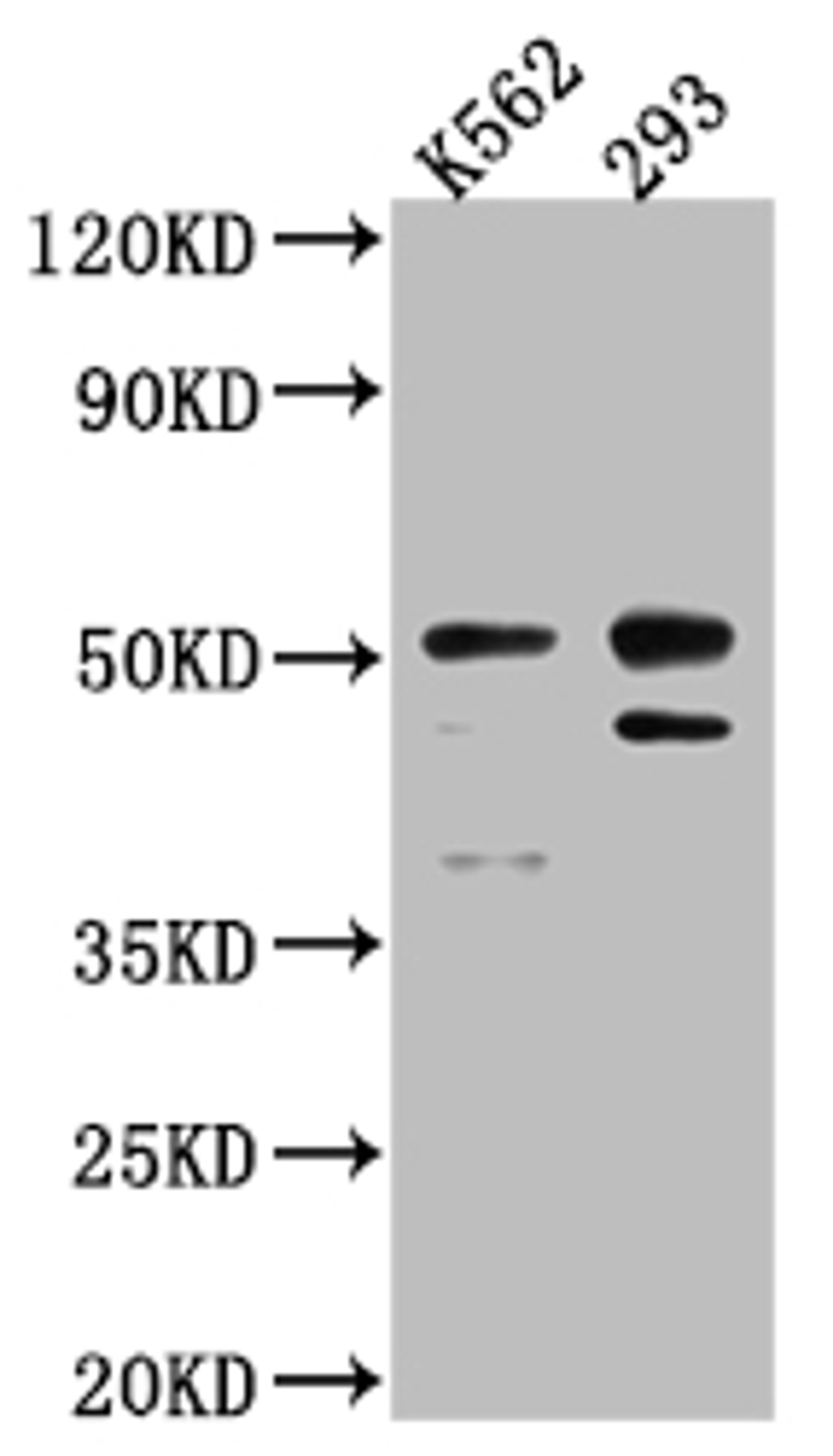 Western Blot. Positive WB detected in: K562 whole cell lysate, 293 whole cell lysate. All lanes: Caspase-2 antibody at 1:1000. Secondary. Goat polyclonal to rabbit IgG at 1/50000 dilution. Predicted band size: 51, 35, 11 kDa. Observed band size: 51 kDa.