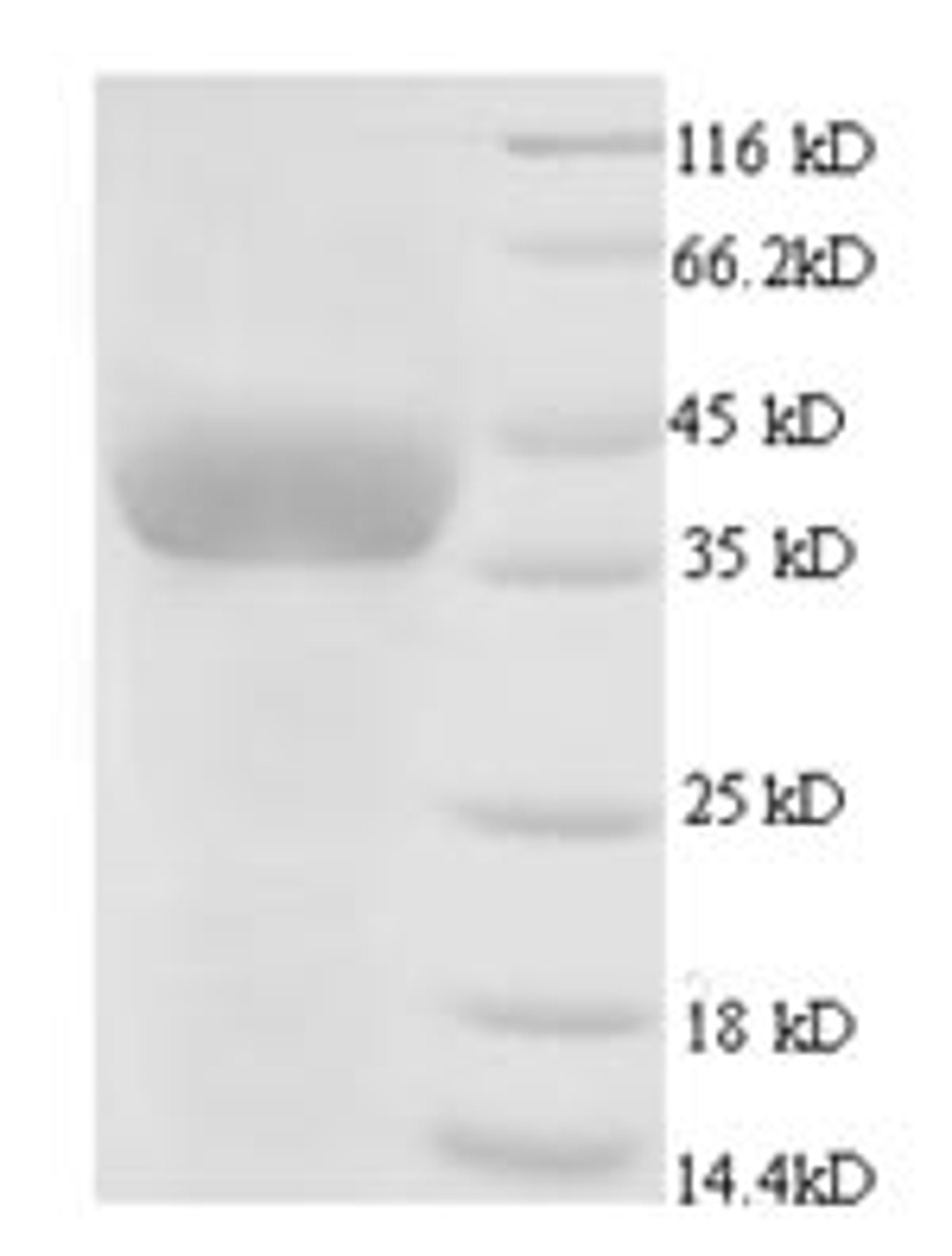 (Tris-Glycine gel) Discontinuous SDS-PAGE (reduced) with 5% enrichment gel and 15% separation gel.
