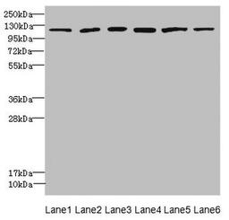 Western blot. All lanes: UBE4A antibody at 2.24µg/ml. Lane 1: K562 whole cell lysate. Lane 2: MCF-7 whole cell lysate. Lane 3: Jurkat whole cell lysate. Lane 4: Caco-2 whole cell lysate. Lane 5: HepG2 whole cell lysate. Lane 6: 293T whole cell lysate. Secondary. Goat polyclonal to rabbit IgG at 1/10000 dilution. Predicted band size: 123, 124 kDa. Observed band size: 123 kDa