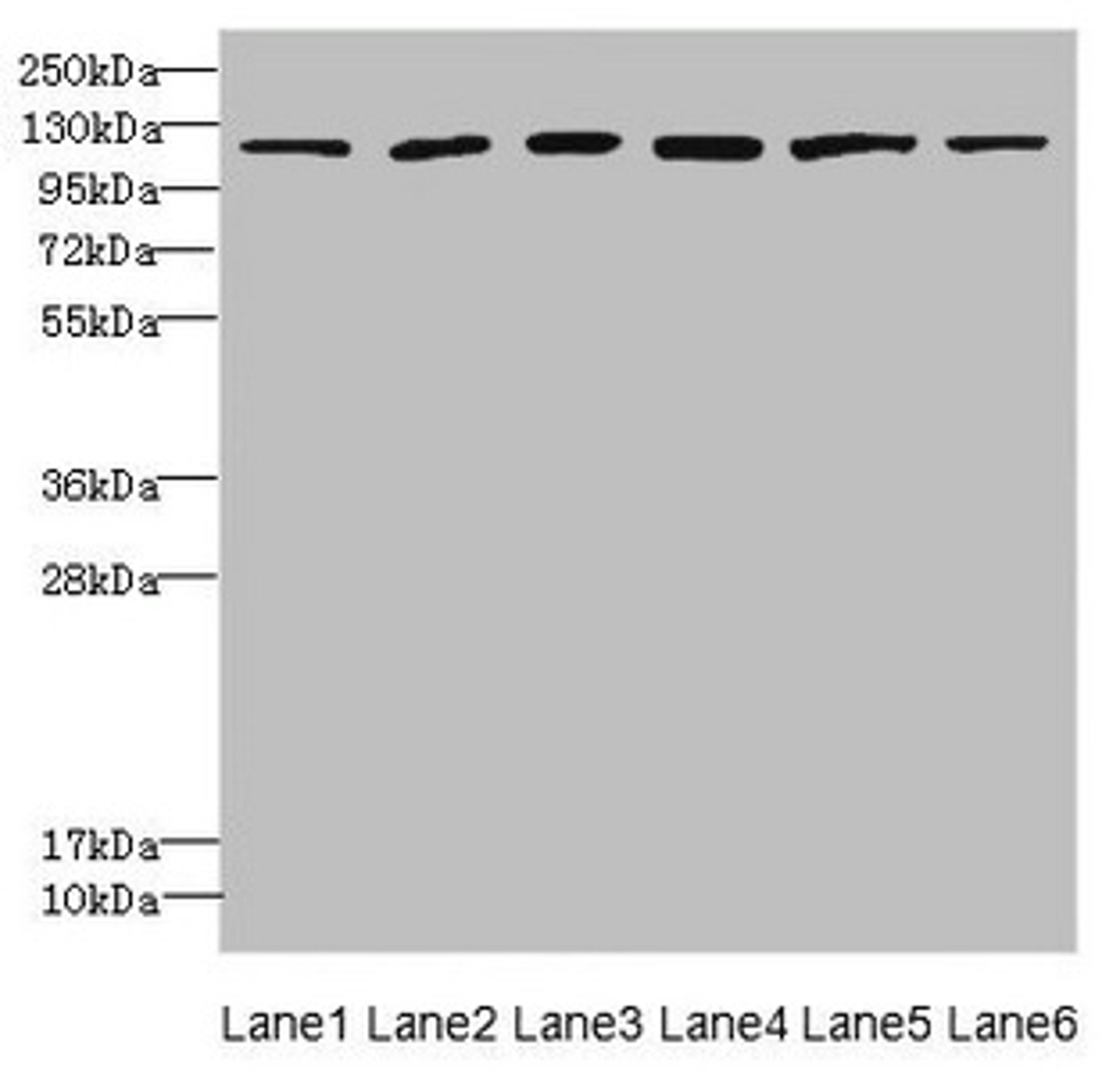 Western blot. All lanes: UBE4A antibody at 2.24µg/ml. Lane 1: K562 whole cell lysate. Lane 2: MCF-7 whole cell lysate. Lane 3: Jurkat whole cell lysate. Lane 4: Caco-2 whole cell lysate. Lane 5: HepG2 whole cell lysate. Lane 6: 293T whole cell lysate. Secondary. Goat polyclonal to rabbit IgG at 1/10000 dilution. Predicted band size: 123, 124 kDa. Observed band size: 123 kDa