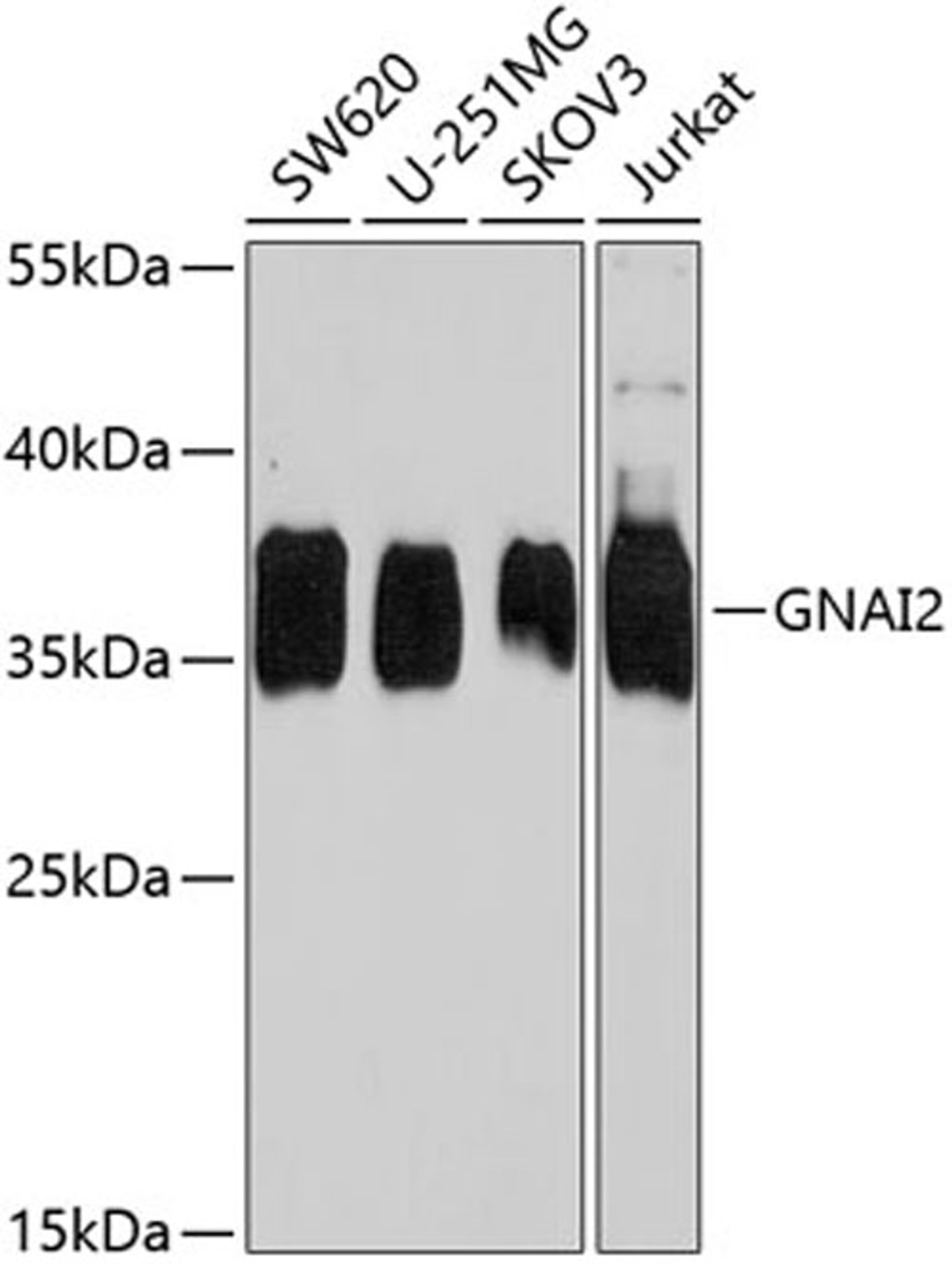 Western blot - GNAI2 antibody (A7676)