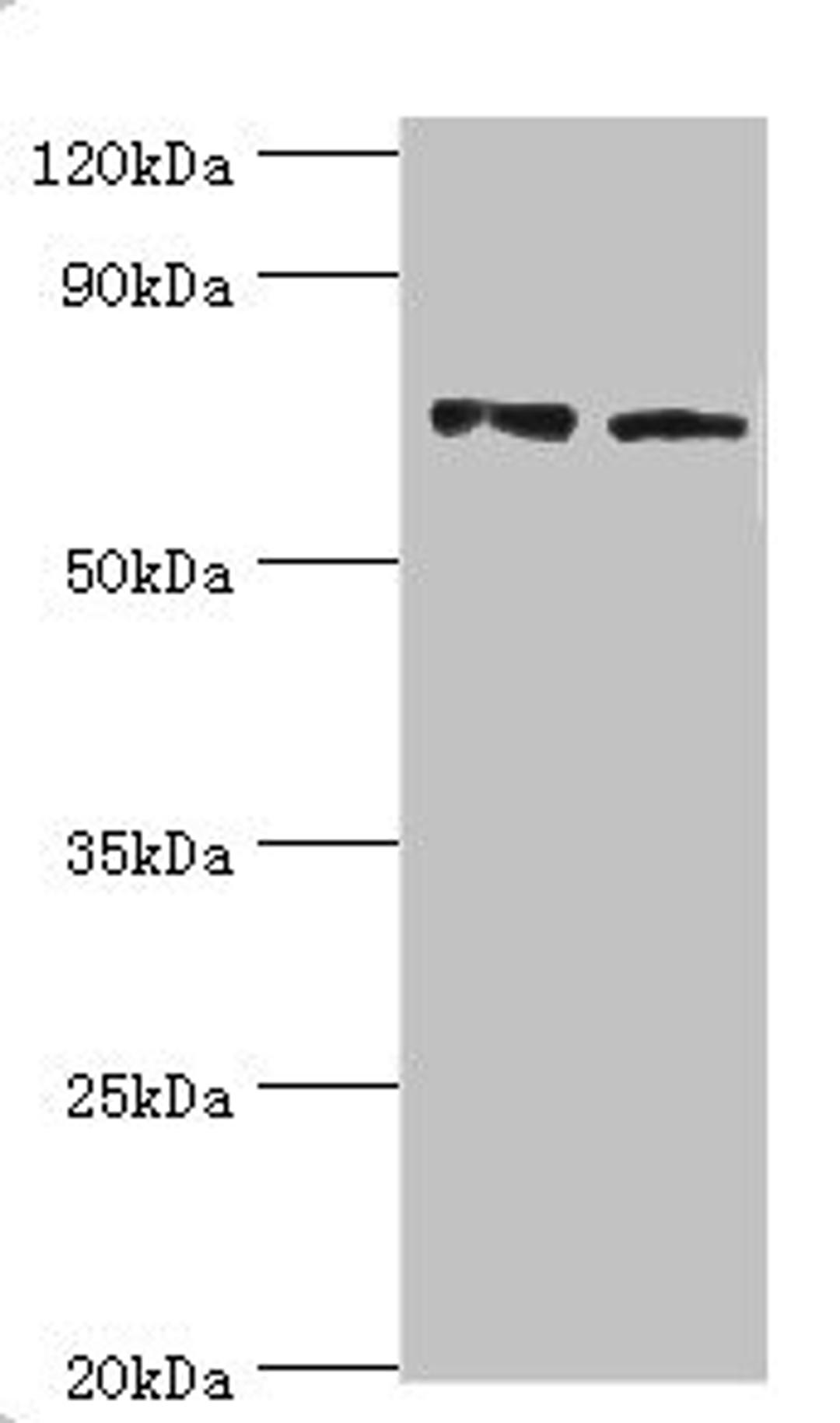 Western blot. All lanes: Annexin A6 antibody at 4ug/ml. Lane 1: Jurkat whole cell lysate. Lane 2: Hela whole cell lysate. Secondary. Goat polyclonal to rabbit IgG at 1/10000 dilution. Predicted band size: 76, 73 kDa. Observed band size: 76 kDa.