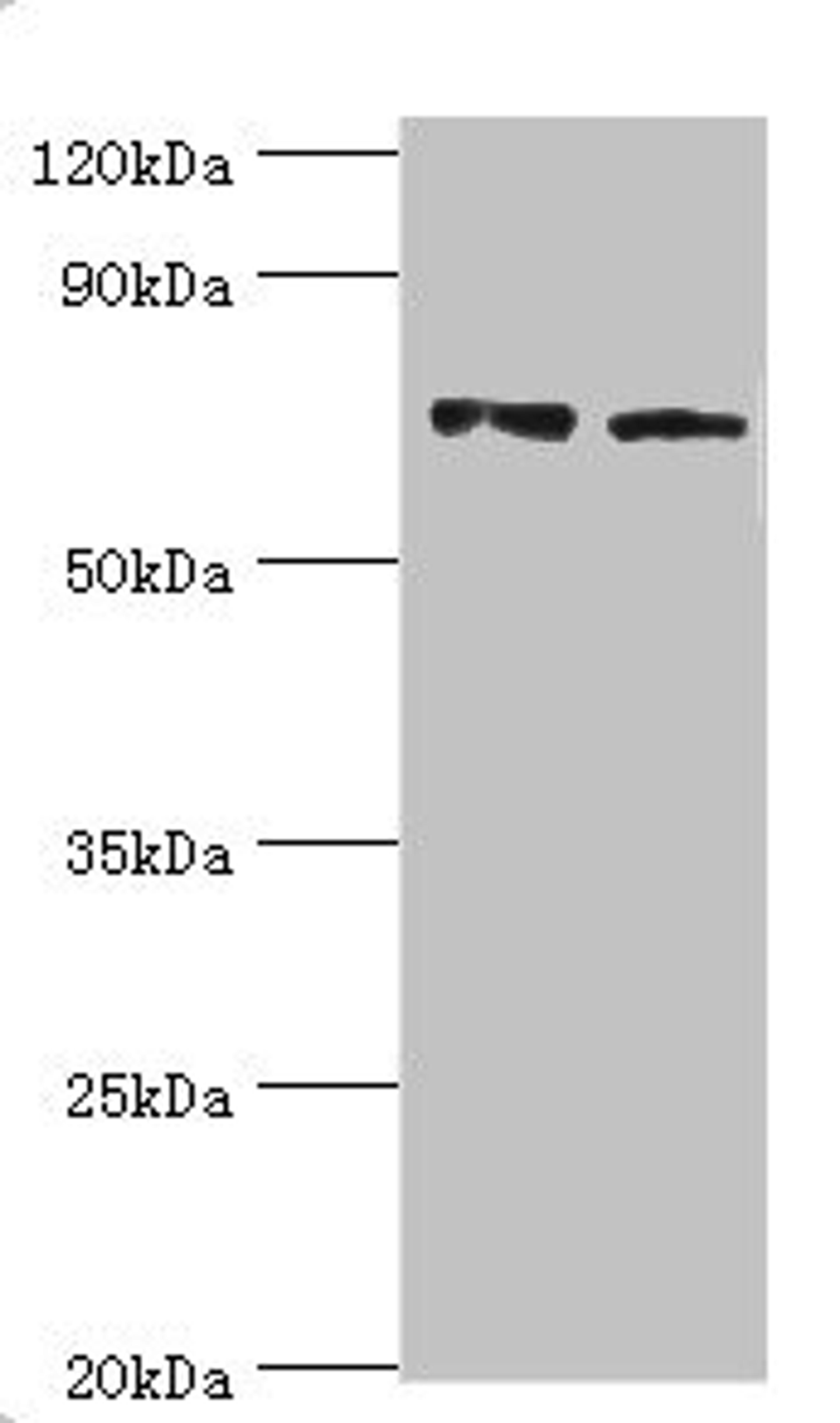 Western blot. All lanes: Annexin A6 antibody at 4ug/ml. Lane 1: Jurkat whole cell lysate. Lane 2: Hela whole cell lysate. Secondary. Goat polyclonal to rabbit IgG at 1/10000 dilution. Predicted band size: 76, 73 kDa. Observed band size: 76 kDa.