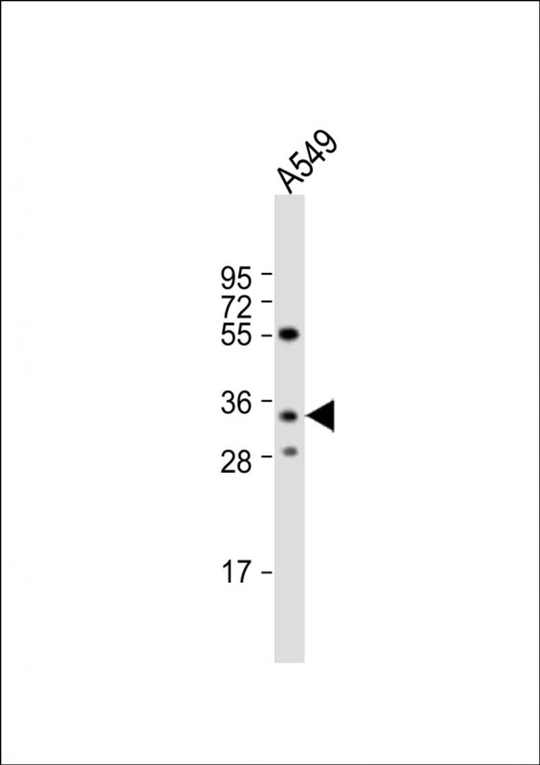 Western Blot at 1:1000 dilution + A549 whole cell lysate Lysates/proteins at 20 ug per lane.