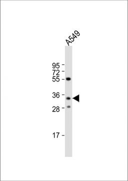 Western Blot at 1:1000 dilution + A549 whole cell lysate Lysates/proteins at 20 ug per lane.