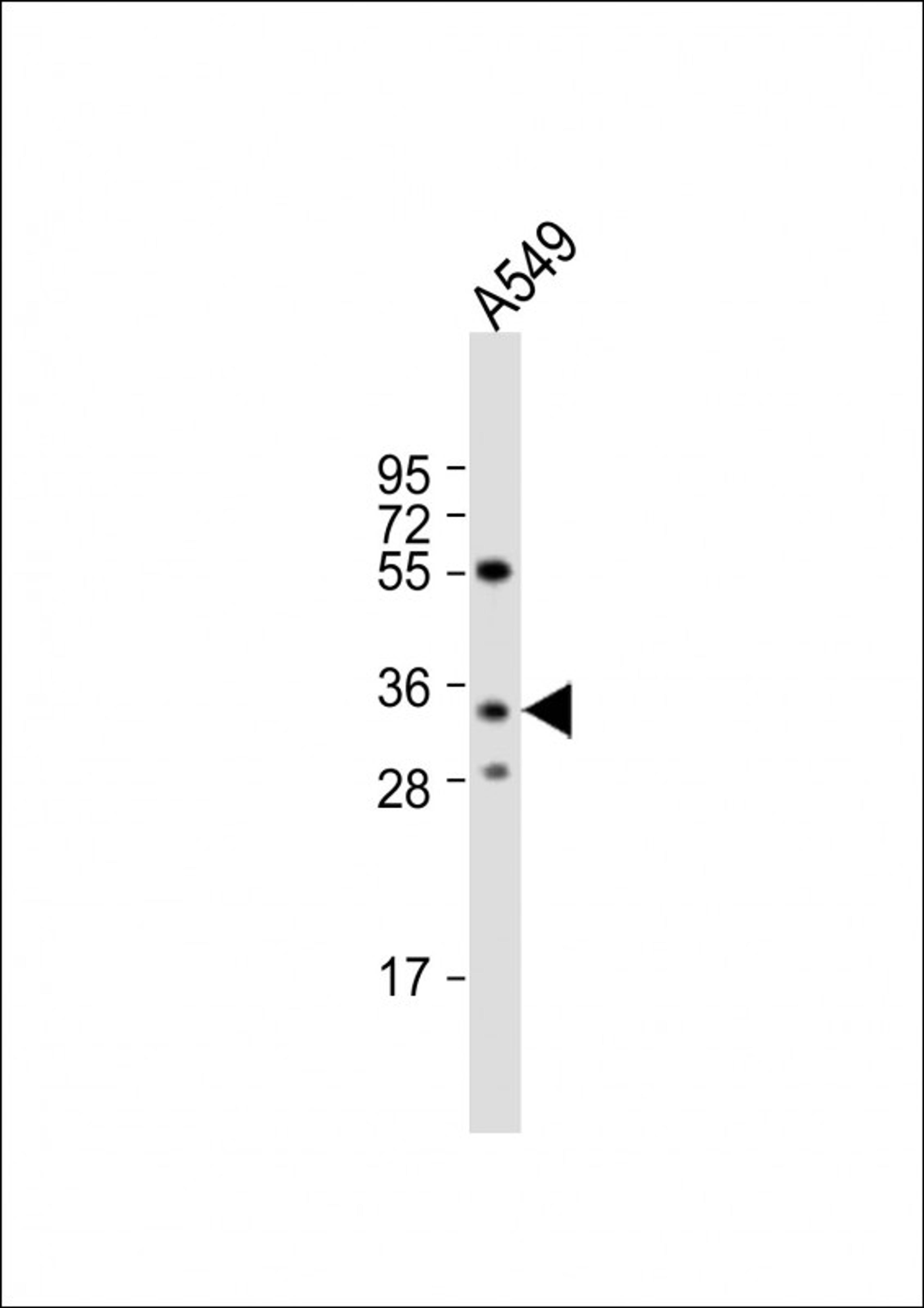 Western Blot at 1:1000 dilution + A549 whole cell lysate Lysates/proteins at 20 ug per lane.