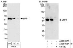 Detection of human LMP1 by western blot and immunoprecipitation.