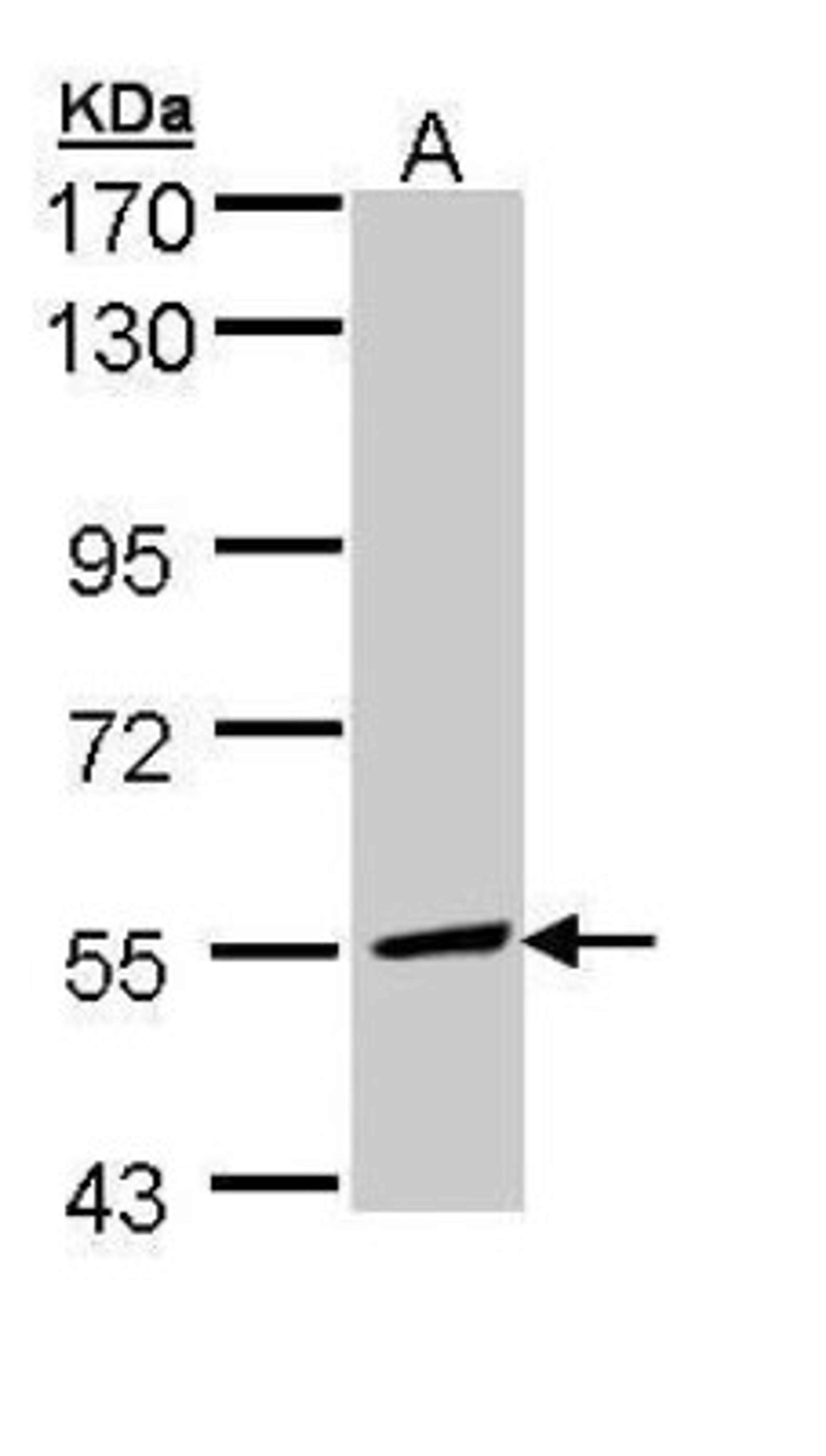 Western Blot: MLYCD Antibody [NBP1-32797] - Sample (30 ug of whole cell lysate) A: Hep G2 7.5% SDS PAGE diluted at 1:1000