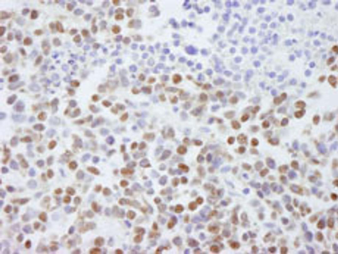 Detection of human SAFB2 by immunohistochemistry.