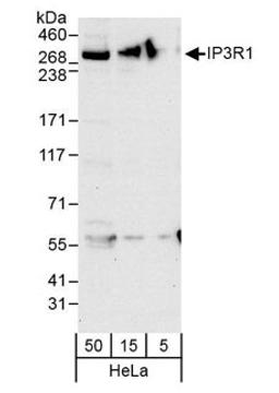 Detection of human IP3R1 by western blot.