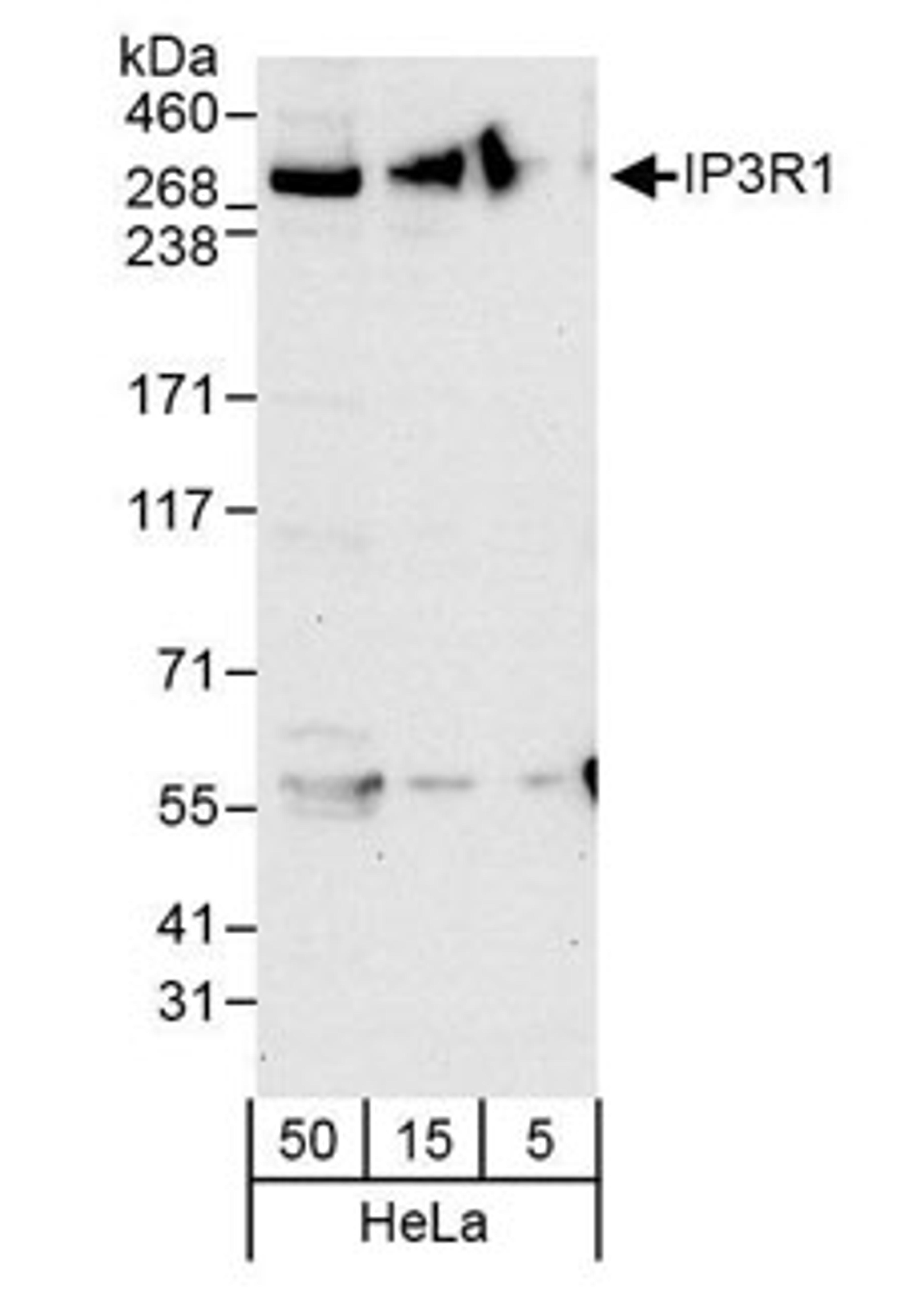 Detection of human IP3R1 by western blot.