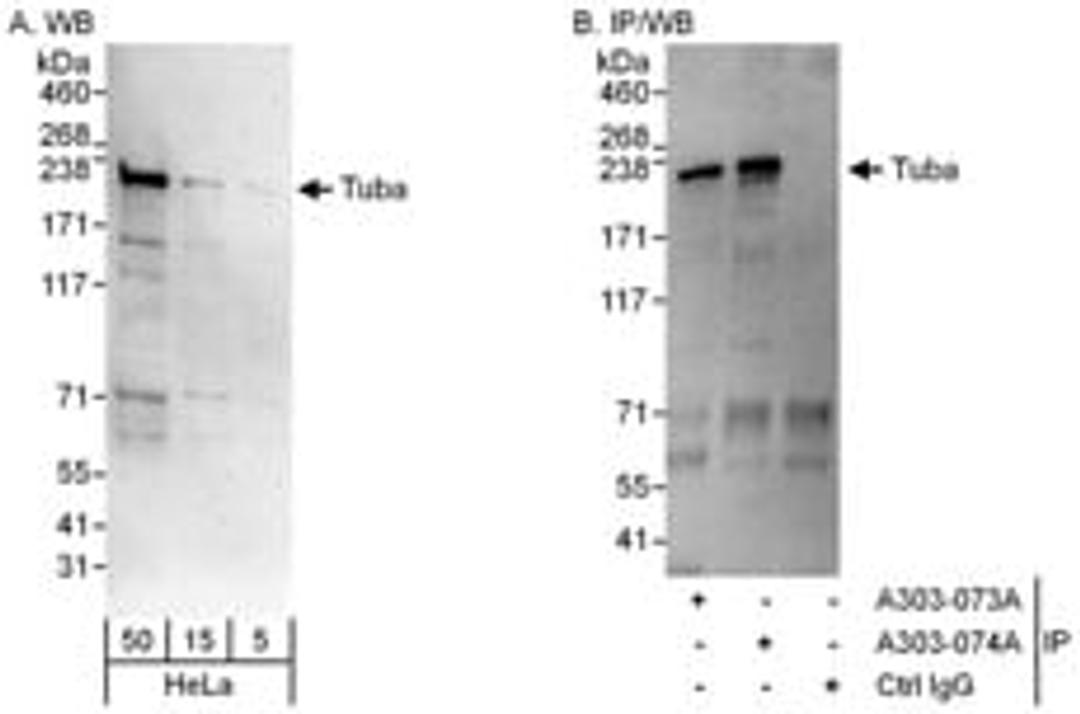 Detection of human Tuba by western blot and immunoprecipitation.