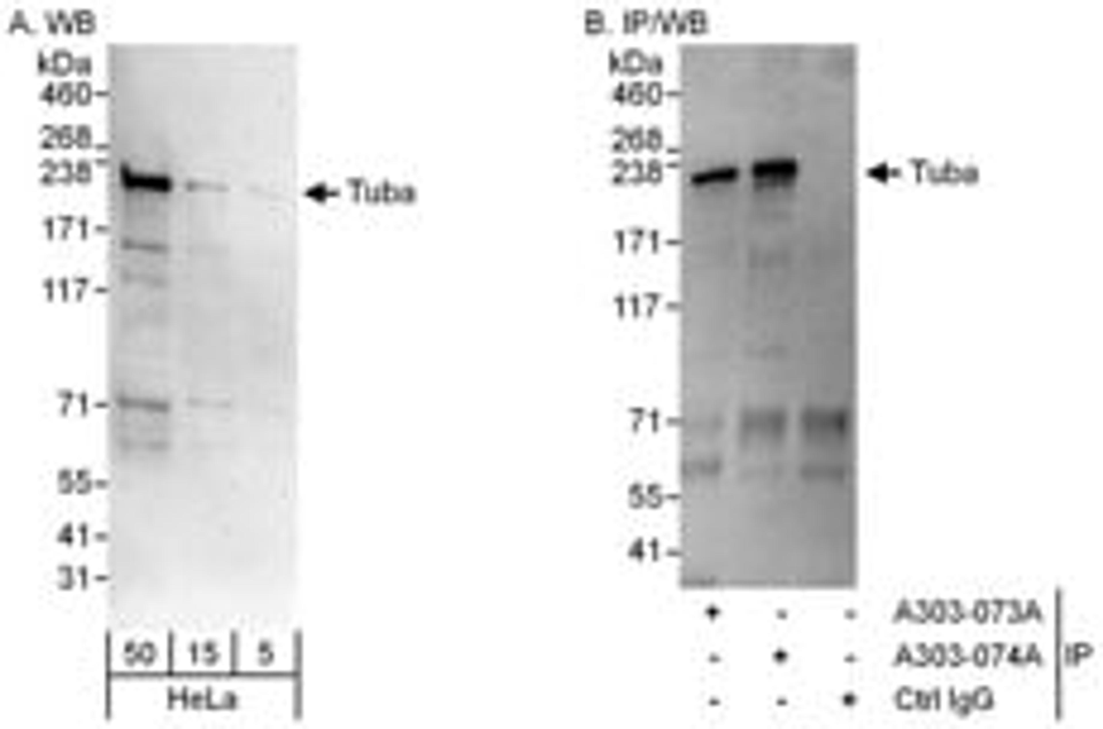 Detection of human Tuba by western blot and immunoprecipitation.