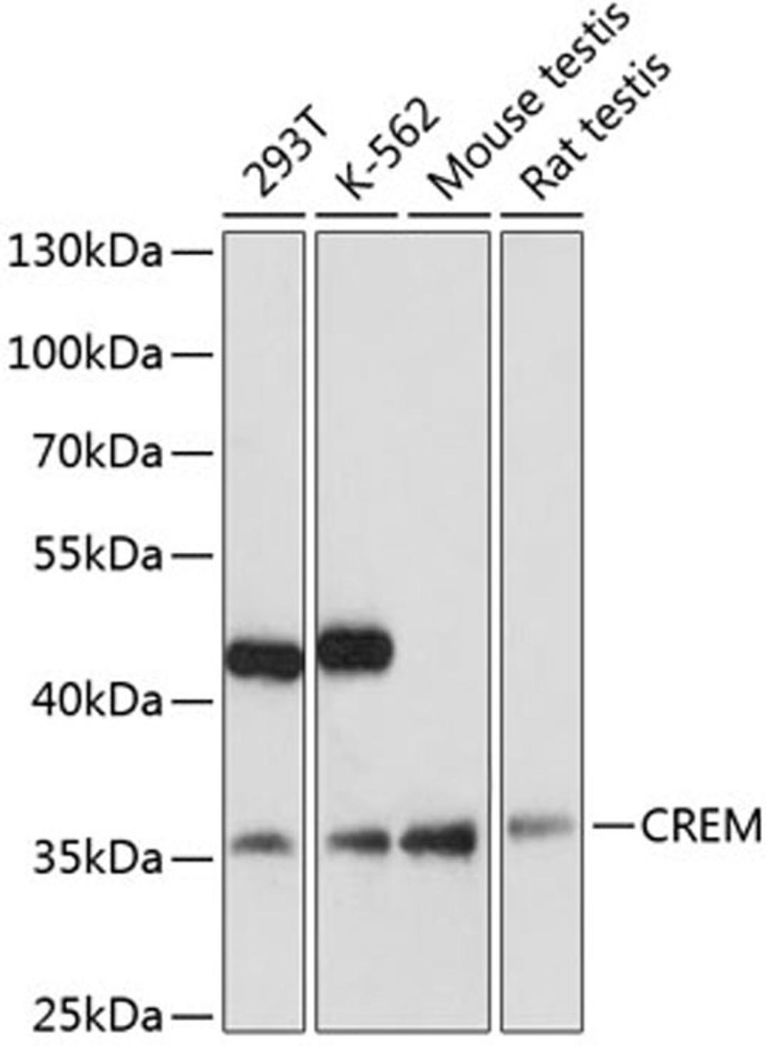 Western blot - CREM antibody (A5624)