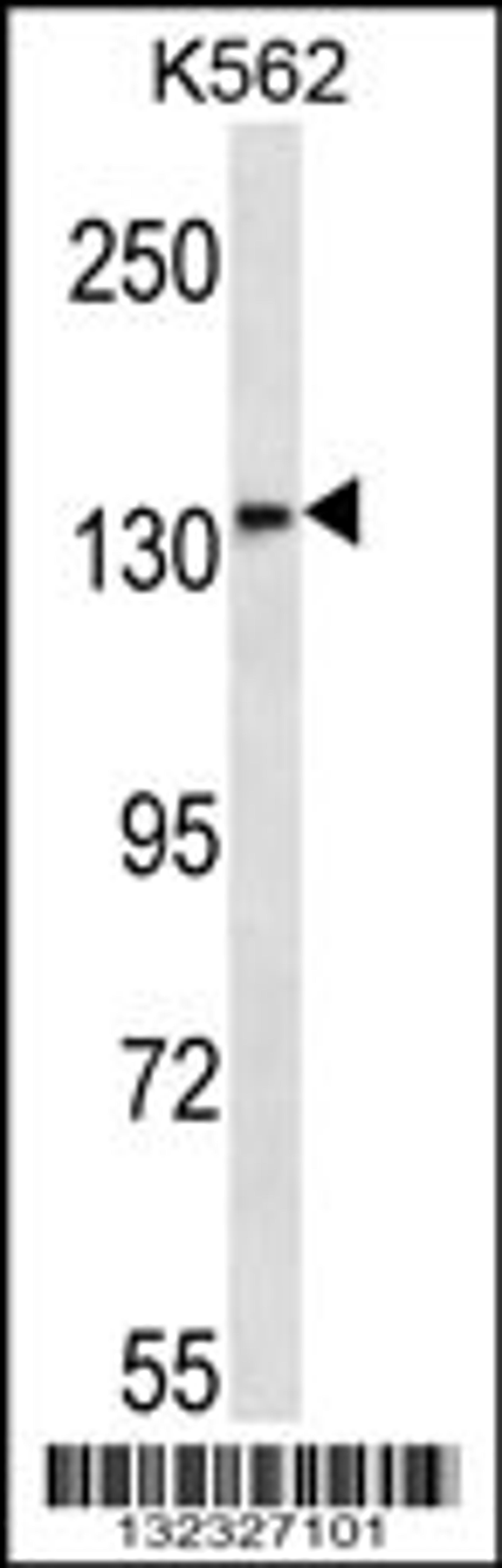 Western blot analysis in K562 cell line lysates (35ug/lane).