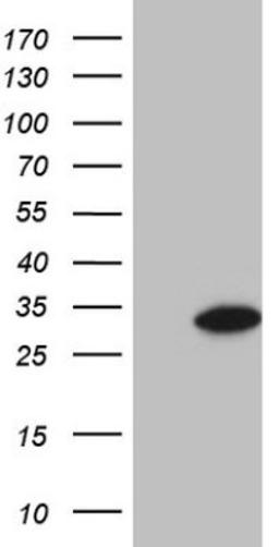 Western Blot: GLYAT Antibody (4D1) [NBP2-45897] - Analysis of HEK293T cells were transfected with the pCMV6-ENTRY control (Left lane) or pCMV6-ENTRY GLYAT.