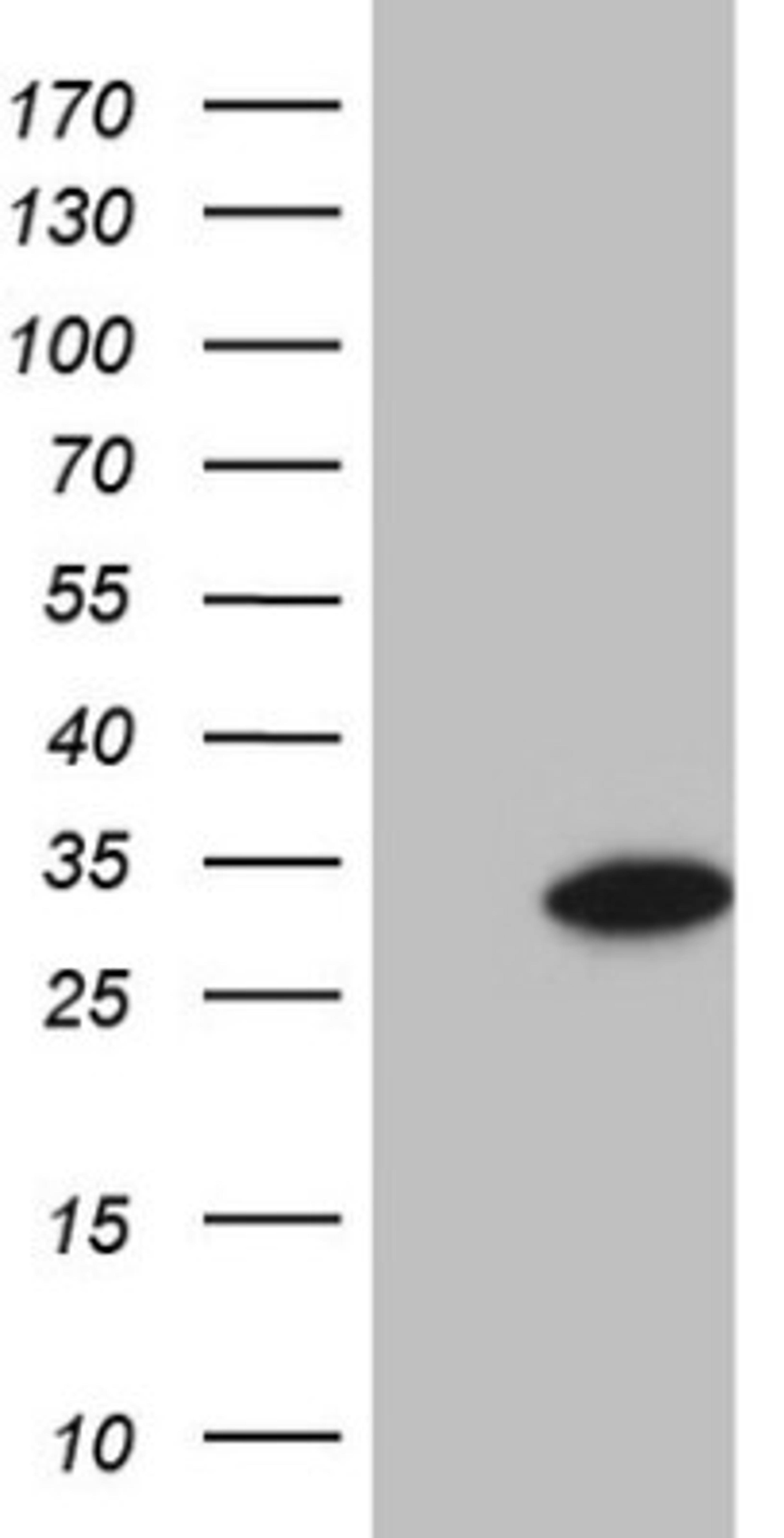 Western Blot: GLYAT Antibody (4D1) [NBP2-45897] - Analysis of HEK293T cells were transfected with the pCMV6-ENTRY control (Left lane) or pCMV6-ENTRY GLYAT.