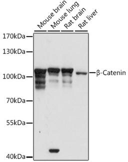 Western blot - ß-Catenin antibody (A11512)