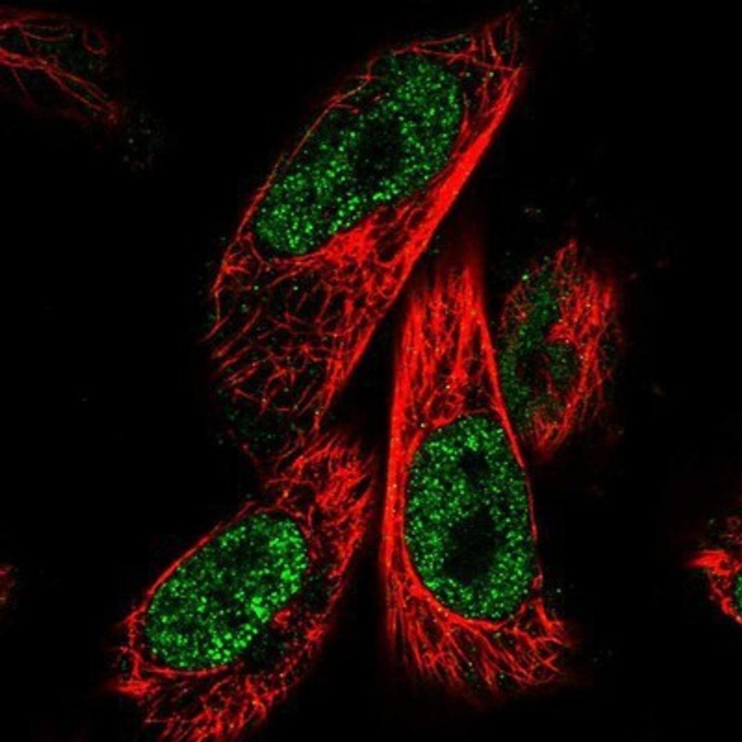 Immunocytochemistry/Immunofluorescence: ZNF480 Antibody [NBP1-81124] - Staining of human cell line U-251 MG shows positivity in nucleus but not nucleoli.