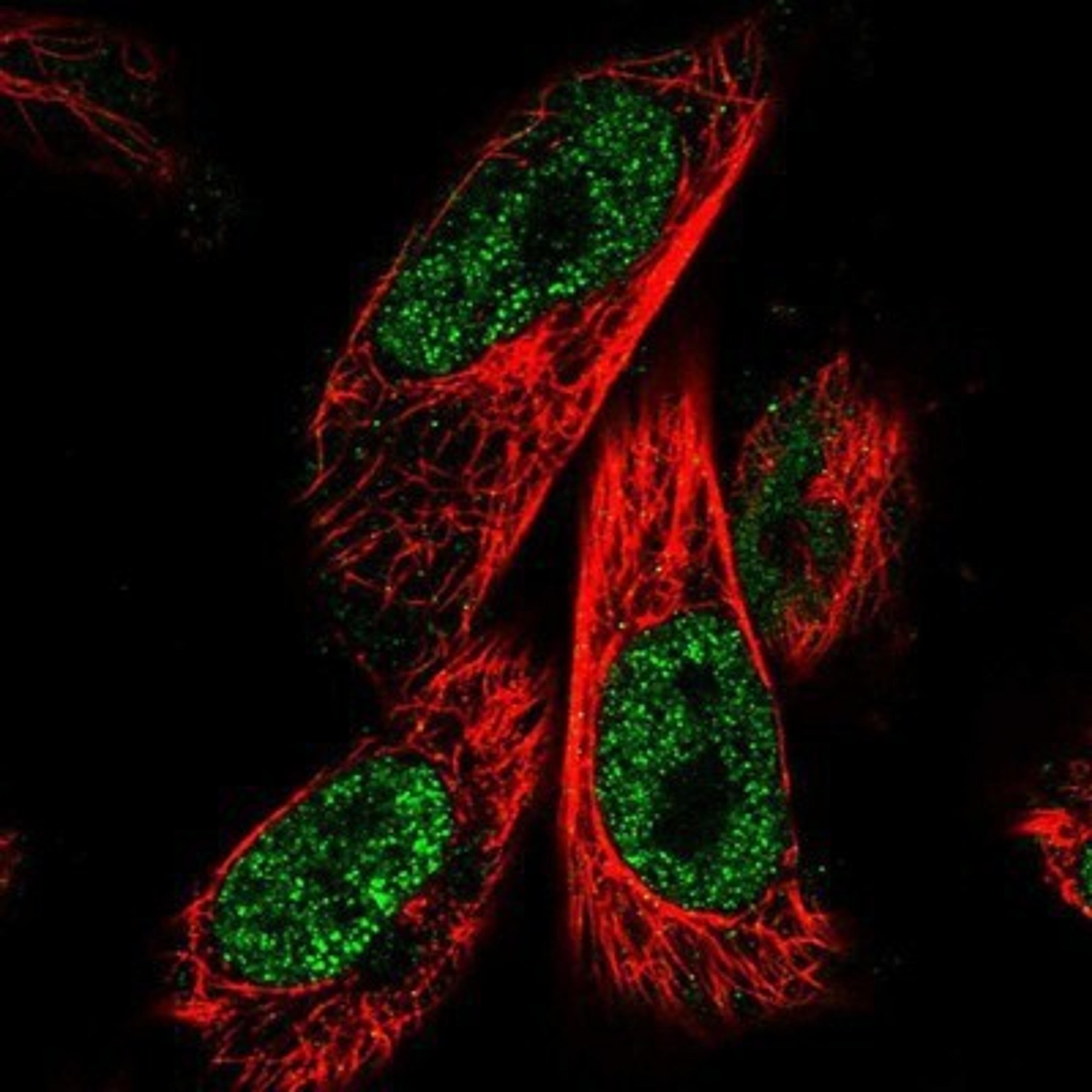 Immunocytochemistry/Immunofluorescence: ZNF480 Antibody [NBP1-81124] - Staining of human cell line U-251 MG shows positivity in nucleus but not nucleoli.