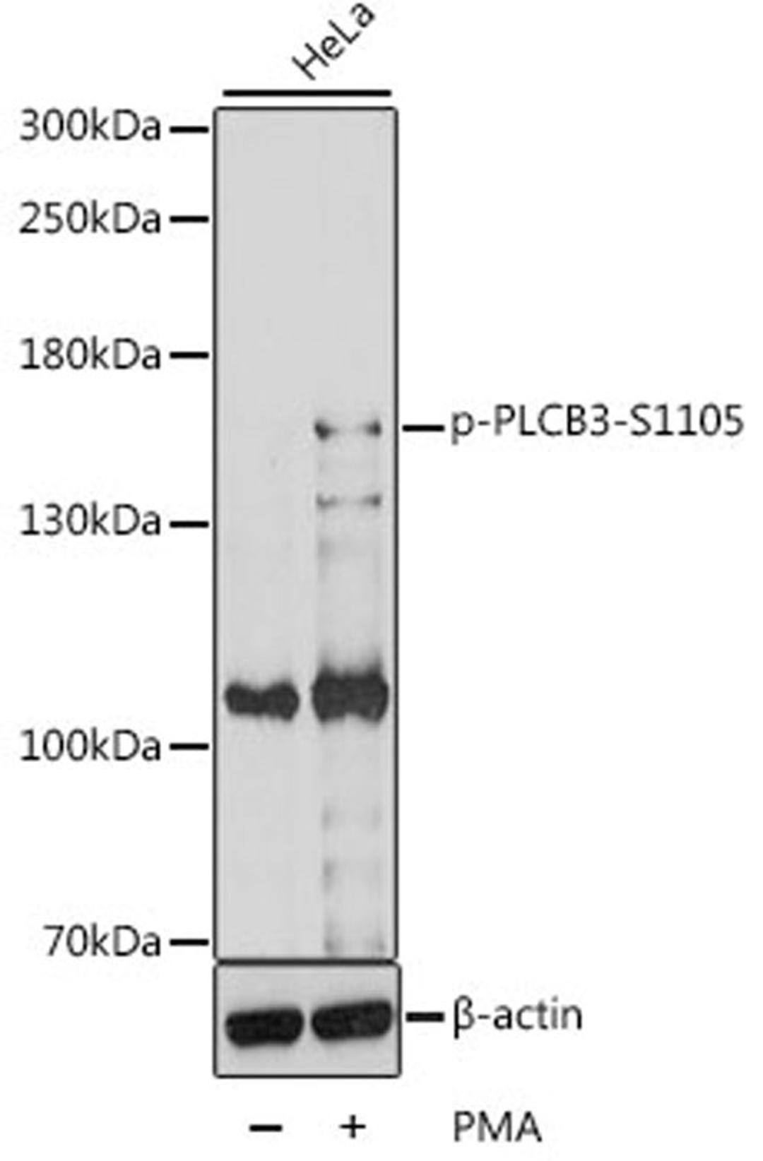 Western blot - Phospho-PLCB3-S1105 antibody (AP0837)