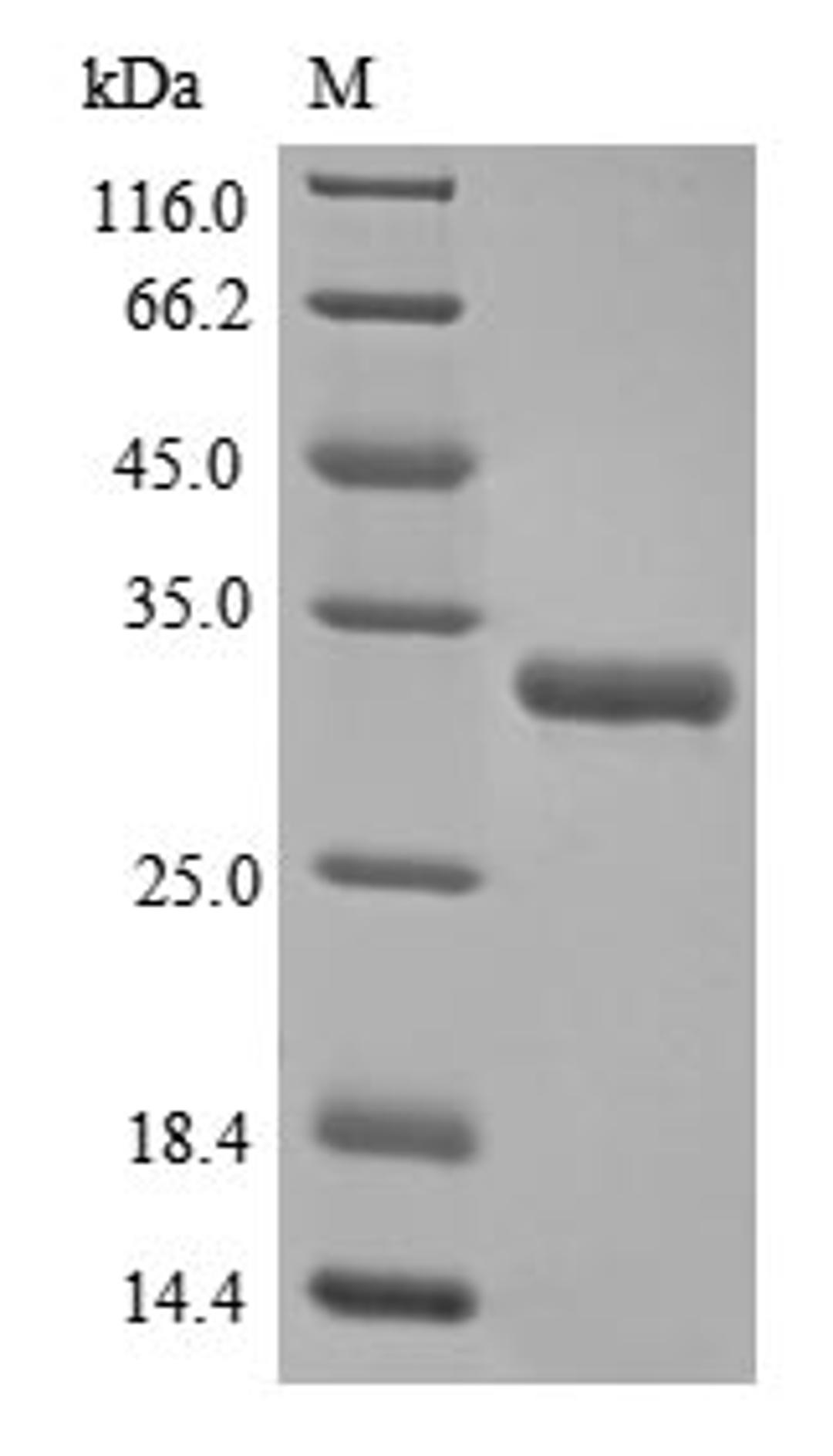 (Tris-Glycine gel) Discontinuous SDS-PAGE (reduced) with 5% enrichment gel and 15% separation gel.